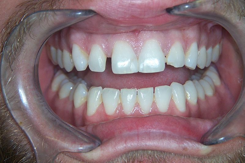 Smile Gallery | Dentist in Mobile, AL